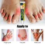 1Pcs Bunion Gout Pain Relief Ointment Toe Joint Pain Hallux Valgus Corrector Knee Lumbar Back Pain Treatment Herbal Cream G049 - Image 2