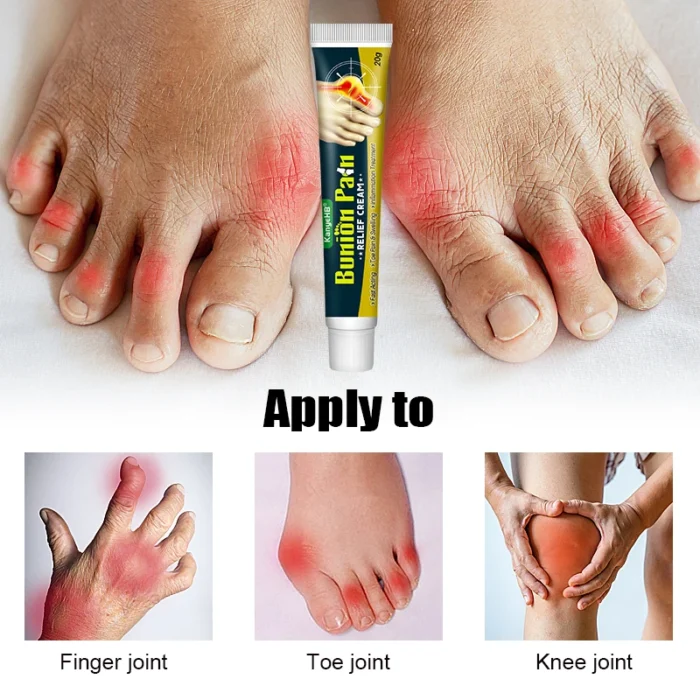 1Pcs Bunion Gout Pain Relief Ointment Toe Joint Pain Hallux Valgus Corrector Knee Lumbar Back Pain Treatment Herbal Cream G049 - Image 2