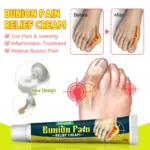 1Pcs Bunion Gout Pain Relief Ointment Toe Joint Pain Hallux Valgus Corrector Knee Lumbar Back Pain Treatment Herbal Cream G049 - Image 3