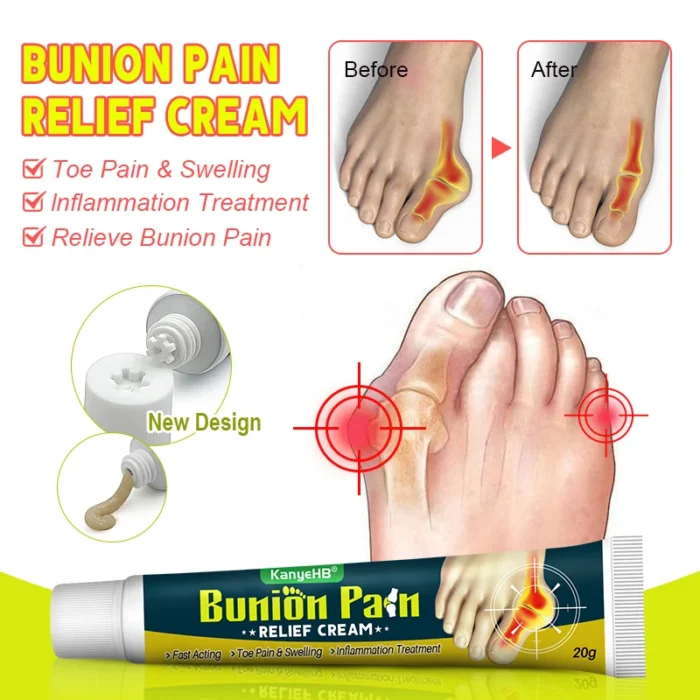 1Pcs Bunion Gout Pain Relief Ointment Toe Joint Pain Hallux Valgus Corrector Knee Lumbar Back Pain Treatment Herbal Cream G049 - Image 3