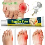 1Pcs Bunion Gout Pain Relief Ointment Toe Joint Pain Hallux Valgus Corrector Knee Lumbar Back Pain Treatment Herbal Cream G049