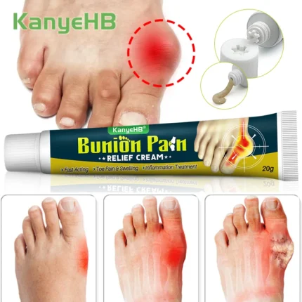 1Pcs Bunion Gout Pain Relief Ointment Toe Joint Pain Hallux Valgus Corrector Knee Lumbar Back Pain Treatment Herbal Cream G049