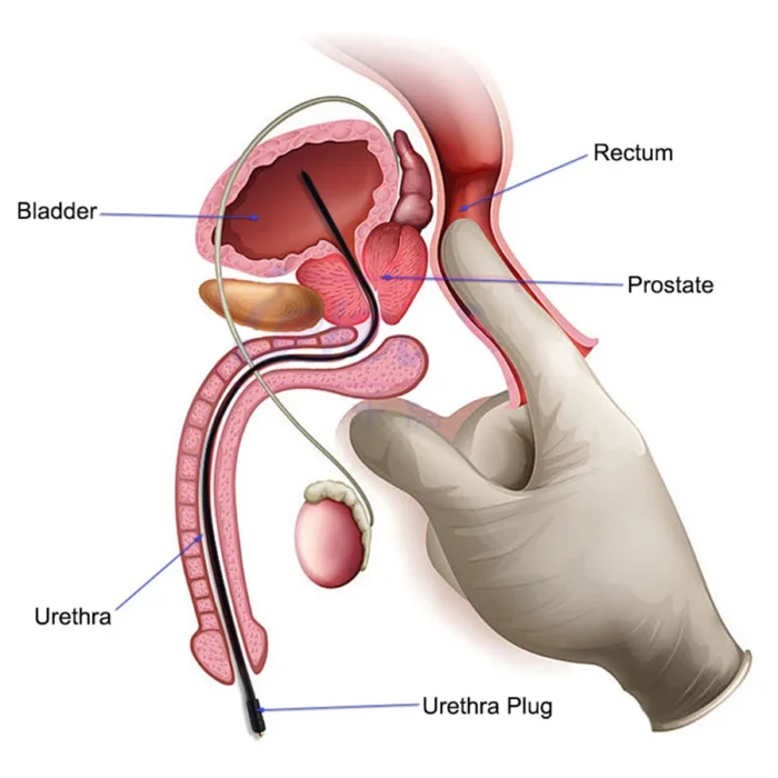 Male Masturbator Electro Shock Horse Eye Stick Medical Stimulator Adult Supply Sex Toys For Men Urethral Dilation Extender Plug - Image 3