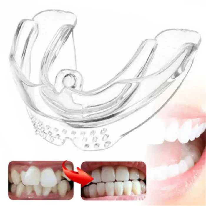Orthodontic Braces Appliance Dental Braces Silicone Alignment Trainer Teeth Retainer Bruxism Mouth Duard Teeth Straightener - Image 1