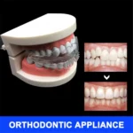 Orthodontic Braces Appliance Dental Braces Silicone Alignment Trainer Teeth Retainer Bruxism Mouth Duard Teeth Straightener - Image 4