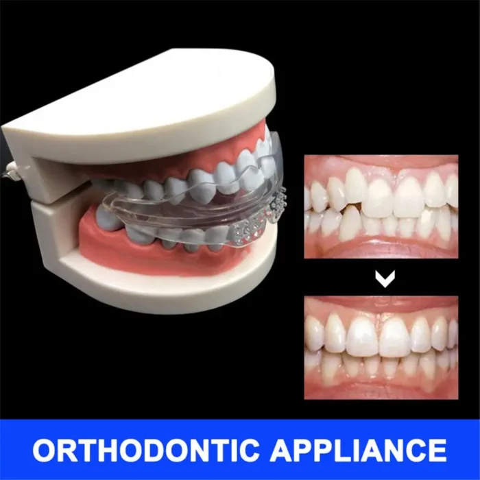 Orthodontic Braces Appliance Dental Braces Silicone Alignment Trainer Teeth Retainer Bruxism Mouth Duard Teeth Straightener - Image 4
