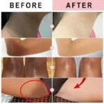 Body Whitening Cream Dark Skin Armpit Lightening Intimate Areas Underarm Bleaching Private Parts Whiten Cream Body Lotion Beauty - Image 2