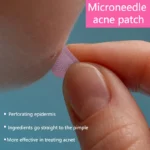 Water Soluble Salicylic Acid Removal Acne Stickers Microneedles Blemish Face Treatment Healing Skin Patches Care Tools - Image 2