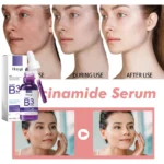 Hoygi Niacinamide Facial Serum Vitamin B3 Wrinkles Pigment Dark Spot Removal Correcting Glow Serum Face Whitening Moisturizer - Image 4