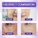 Hoygi Niacinamide Facial Serum Vitamin B3 Wrinkles Pigment Dark Spot Removal Correcting Glow Serum Face Whitening Moisturizer - Image 2