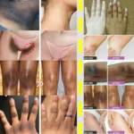 Whitening Cream Private Parts Underarm Bleaching Serum Whiten Butt Knee Brighten Inner Thigh Intimate Parts Dark Remove Melanin - Image 2