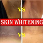 Whitening Cream Private Parts Underarm Bleaching Serum Whiten Butt Knee Brighten Inner Thigh Intimate Parts Dark Remove Melanin - Image 3