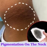 Whitening Cream Private Parts Underarm Bleaching Serum Whiten Butt Knee Brighten Inner Thigh Intimate Parts Dark Remove Melanin - Image 5